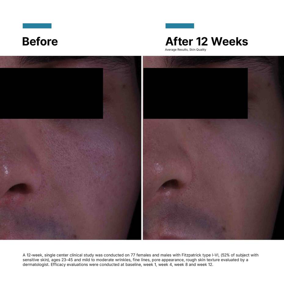 SkinCeuticals P-TIOX Anti-Wrinkle Cream - 48 ml / 1.6 fl oz.