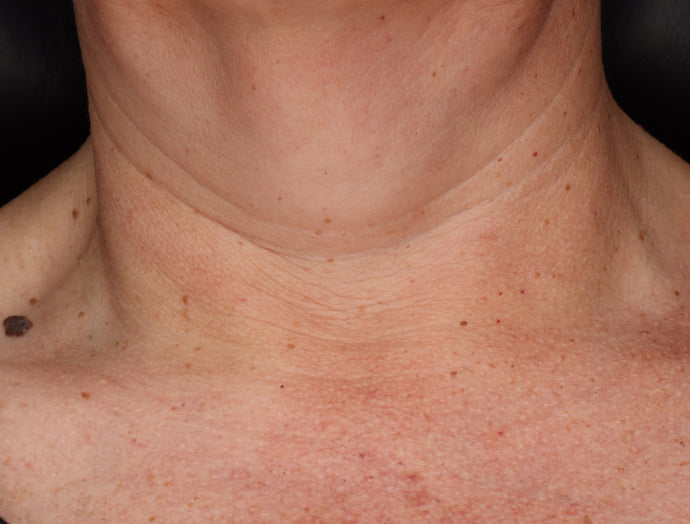 ZO® SKIN HEALTH Neck Complex Anti-Aging + Brightening Serum - 50mL/ 1.7 Fl. Oz.