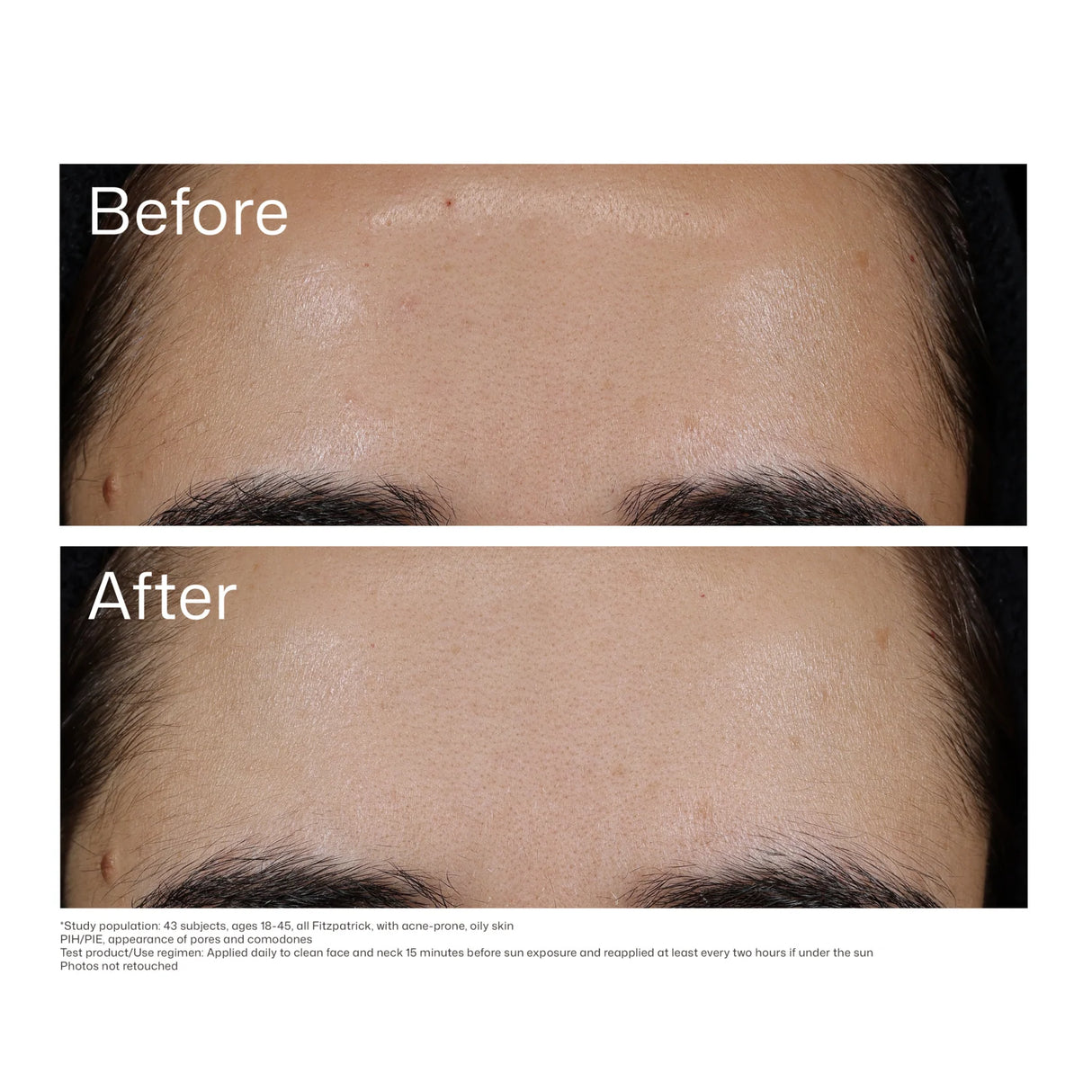 EltaMD® UV Clear Blemish-Prone & Oil Balancing SPF 50 - 1.7 fl. oz. / 48 g