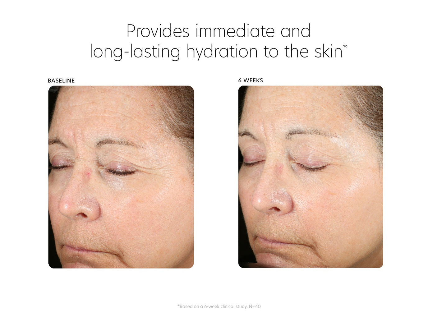 PCA Skin® Hyaluronic Acid Boosting Serum - 1fl oz