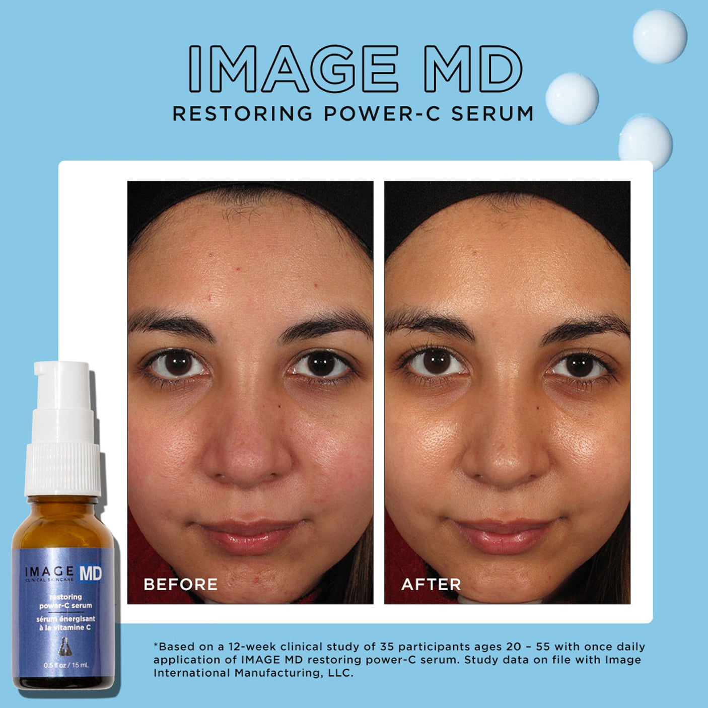 IMAGE Skincare IMAGE MD® Restoring Power-C Serum (Travel-Size)