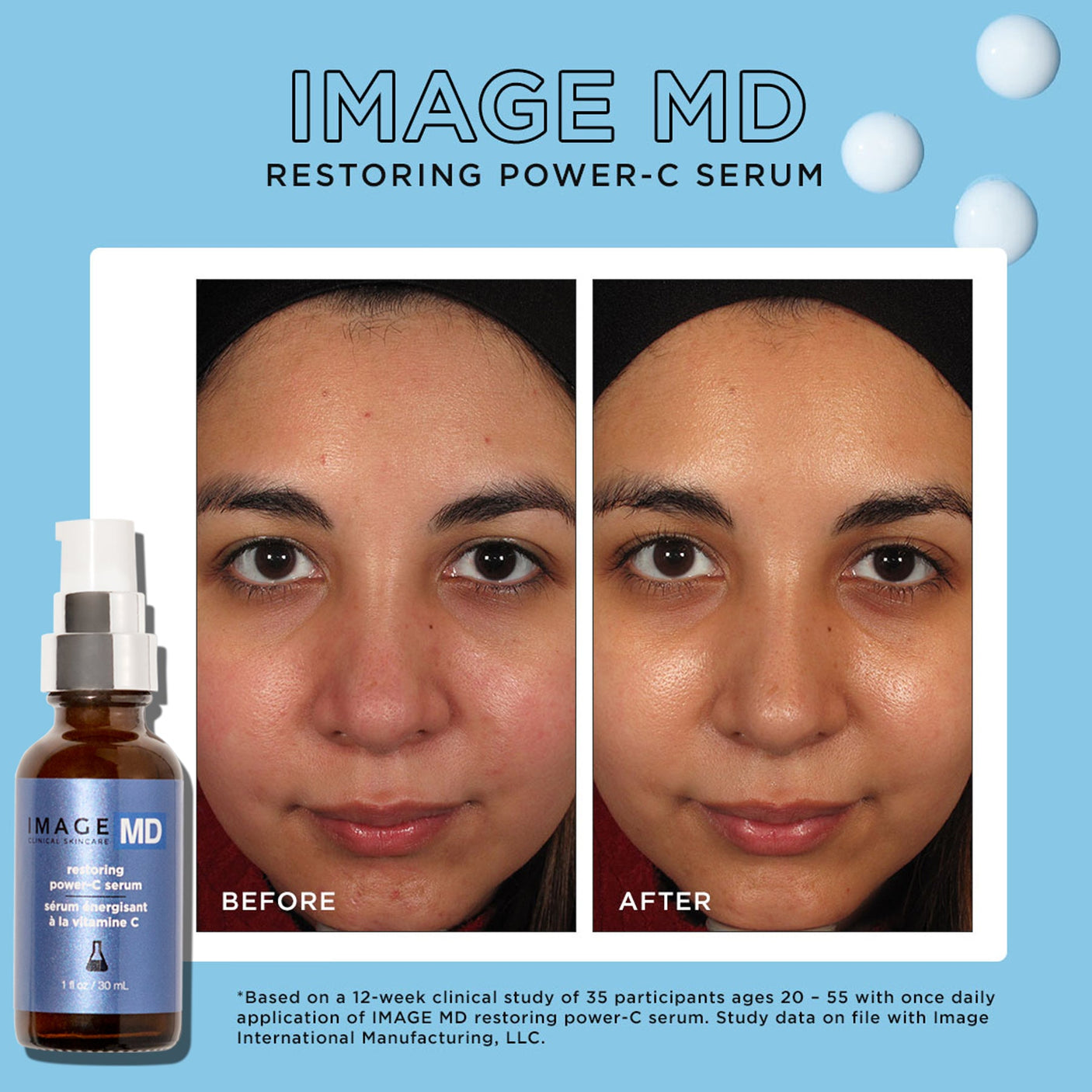 IMAGE Skincare IMAGE MD® Restoring Power-C Serum