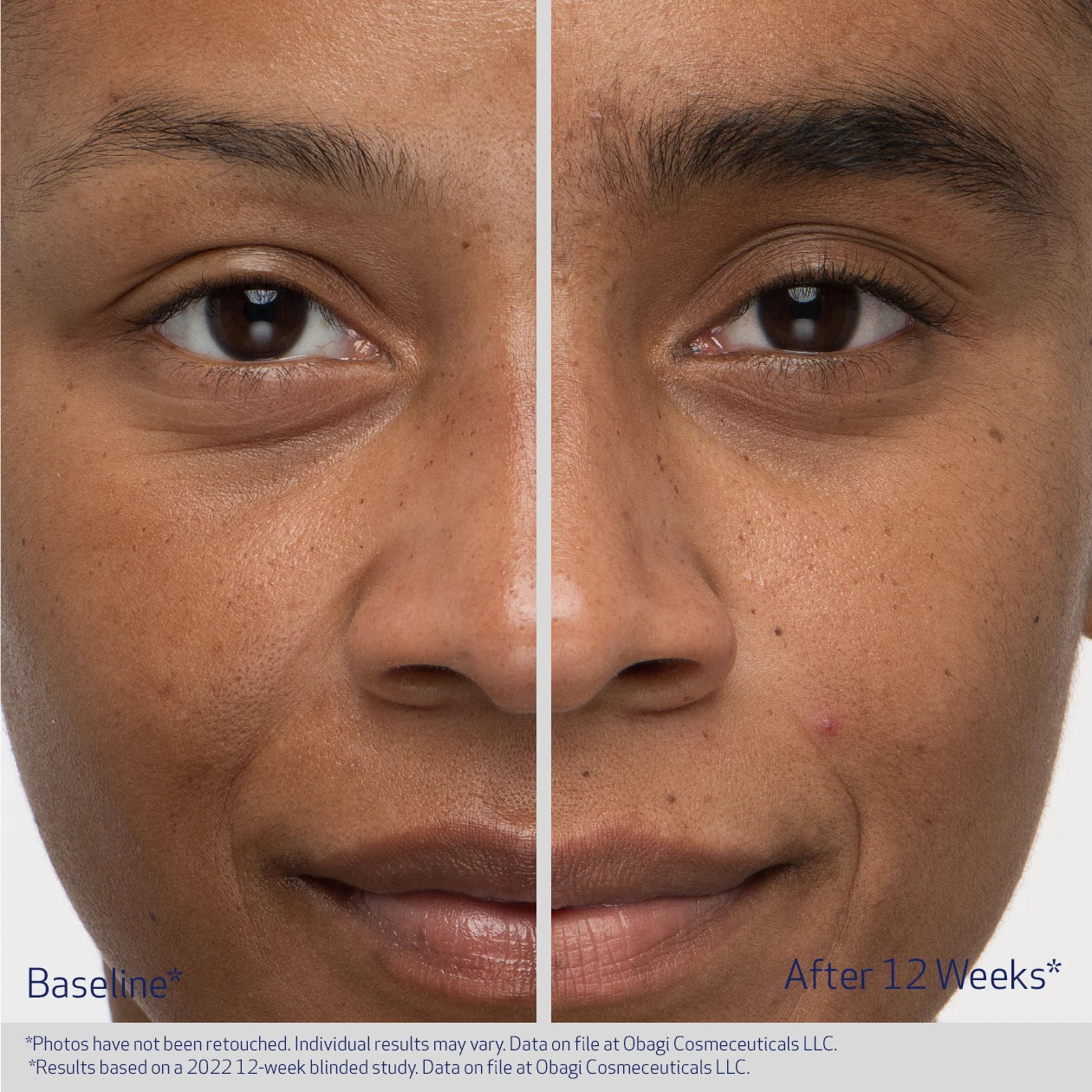 Obagi® Nu-Cil™ EYEBROW BOOSTING SERUM