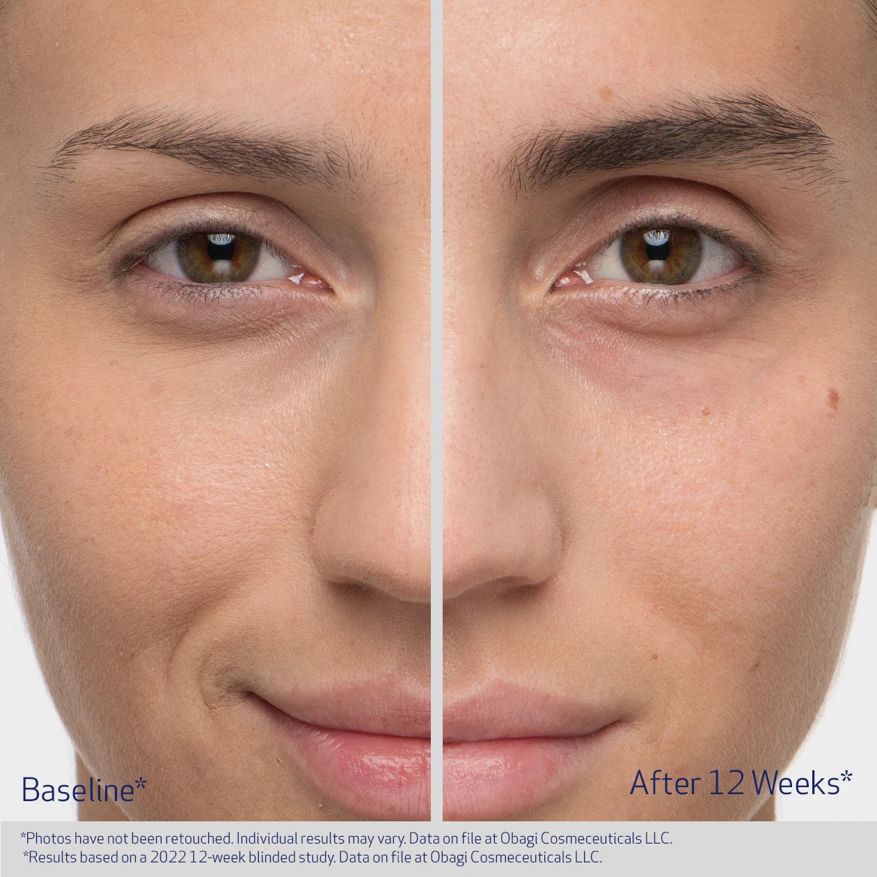 Obagi® Nu-Cil™ EYEBROW BOOSTING SERUM