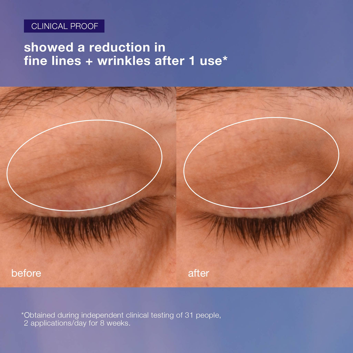 Dermalogica Phyto Nature Lifting Eye Cream - .5 oz