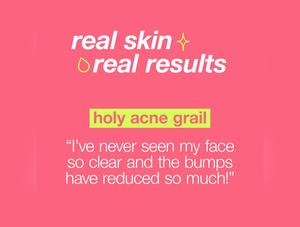 Dermalogica Breakout Clearing Foaming Wash - 10 oz