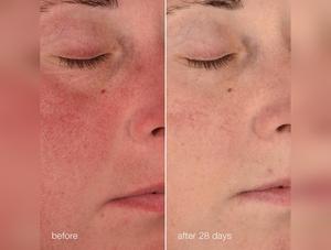 Dermalogica Stabilizing Repair Cream - 1.7 oz