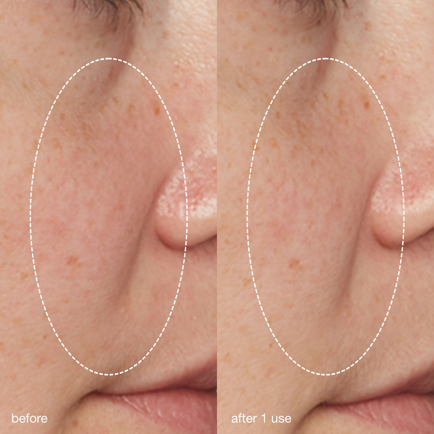 Dermalogica Liquid Peelfoliant - 2.0oz/59ml