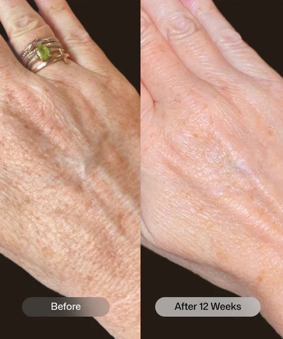 Revision® YouthFull Hands™ 1.7 oz / 48 g