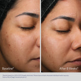 Obagi® RETINOL + PHA - 0.33 fl oz / 10 ml