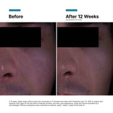 SkinCeuticals P-TIOX Anti-Wrinkle Cream - 48 ml / 1.6 fl oz.