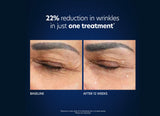 PCA Skin® Hyaluronic Acid Microneedle Eye Patches