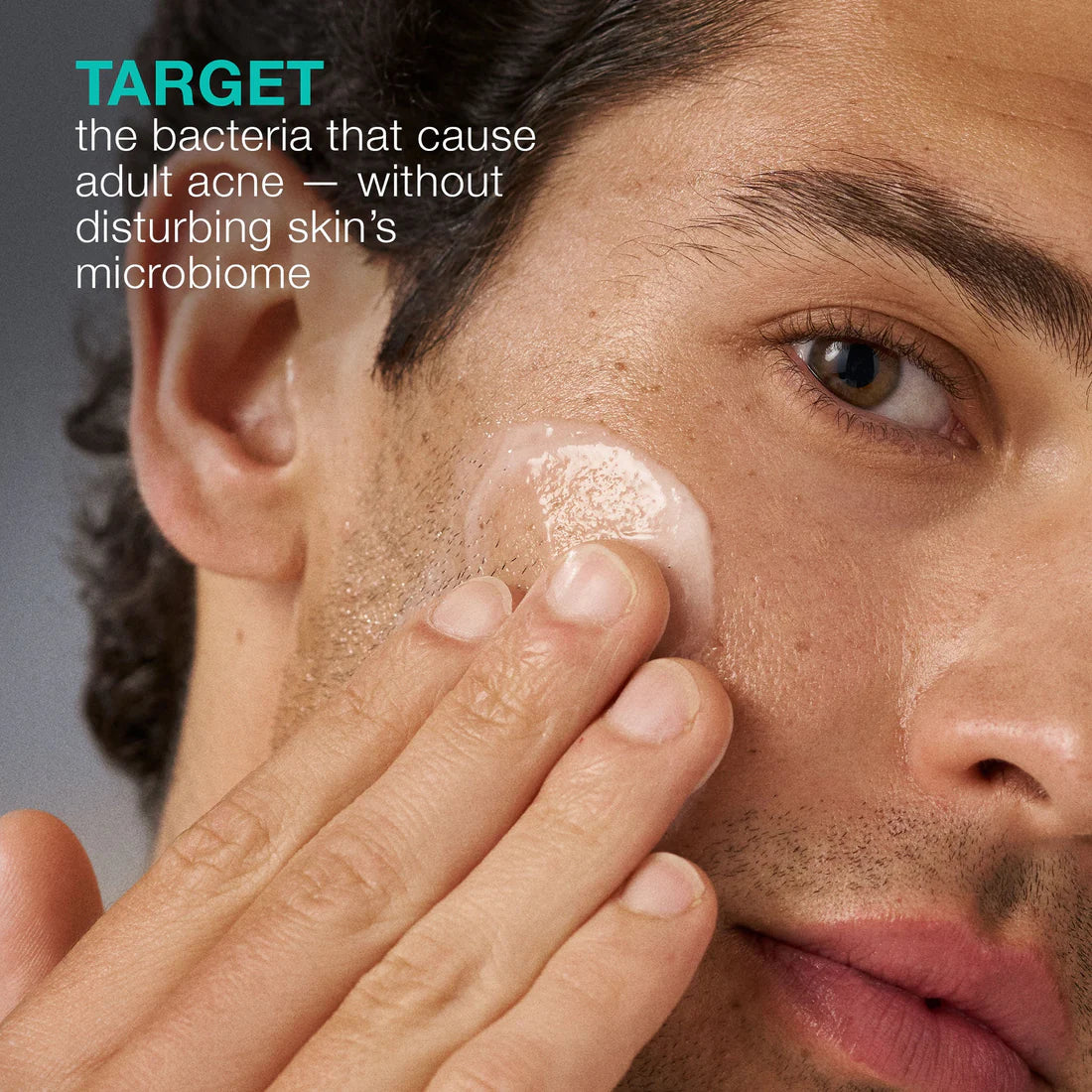 Dermalogica Acne Biotic Moisturizer - 0.24 oz. / 7ml