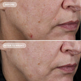 IMAGE AGELESS+ retinol pure liquid retinol 0.75% (travel size)