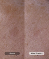 Revision® Advanced Pigment Corrector+ ™ 1 oz