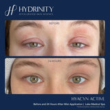 Hydrinity® Rose Gold Hyacyn Active Purifying Mist 90 ml / 3 fl.oz  (Limited Eddition)