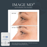 IMAGE Skincare IMAGE MD® Restoring Eye Masks (5 pack)