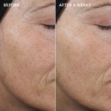 IMAGE AGELESS+ retinol pure liquid retinol 0.3%