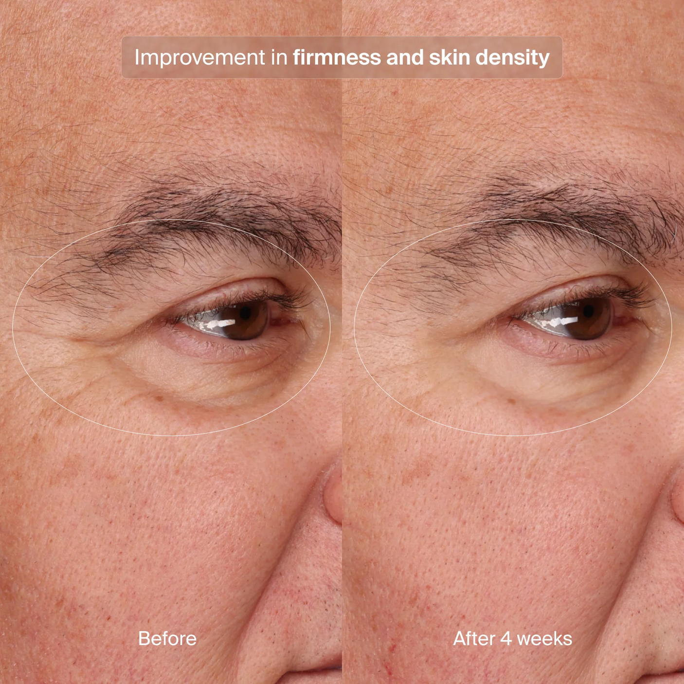 Pavise Precision Eye Lift - 0.5 fl. oz.