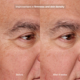 Pavise Precision Eye Lift - 0.5 fl. oz.