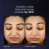 PCA Skin® Pro-Max Age Renewal Deluxe Travel Size - 0.24 oz. / 7 ml