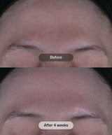Revision® Tone+ Correcting Pads™ 30 Pads