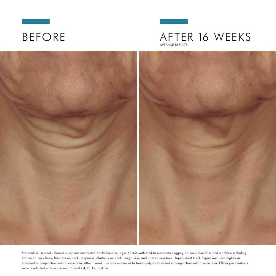 SkinCeuticals TRIPEPTIDE-R NECK REPAIR