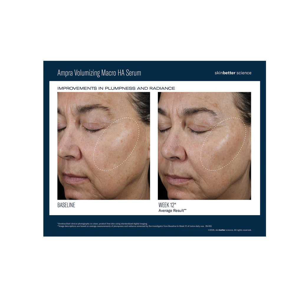 Skinbetter® Better  Ampra Volumizing Macro HA Serum - 1 fl. oz. / 30ml