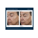 Skinbetter® Better  Ampra Volumizing Macro HA Serum - 1 fl. oz. / 30ml