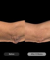 Revision® BodiContour™ 3.8 oz / 107 g
