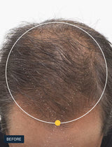 Nutrafol Men 50+