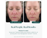 Marini SkinSolutions™ RosaLieve® Redness Reducing Complex - 1 fl. oz.