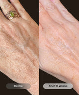 Revision® YouthFull Hands™ 1.7 oz / 48 g